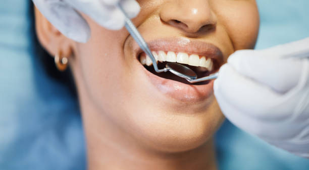 Best Broken or Cracked Tooth Emergency Dentist in Shelbina, MO