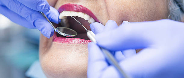 Best Emergency Dental Extractions in Shelbina, MO